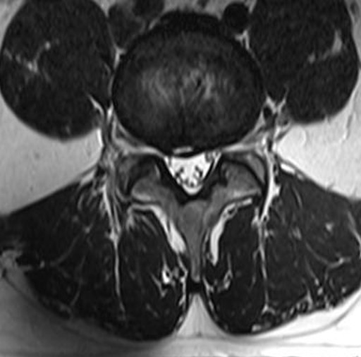 32 yo male RLE pain – Study Spine A to Z